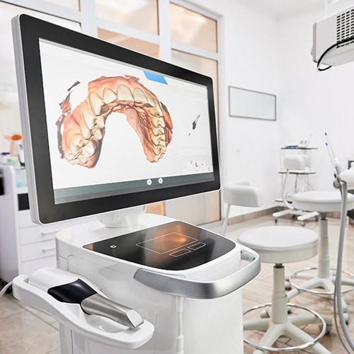 iTero Smile Arc Orthodontics in San Diego, CA